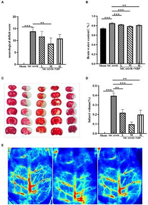 Neuroprotective effect of Dl-3-n-butylphthalide against ischemia–reperfusion injury is mediated by ferroptosis regulation via the SLC7A11/GSH/GPX4 pathway and the attenuation of blood–brain barrier disruption